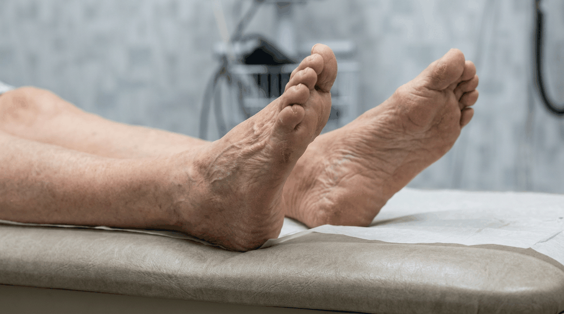 Foot temperature monitoring and gait analysis